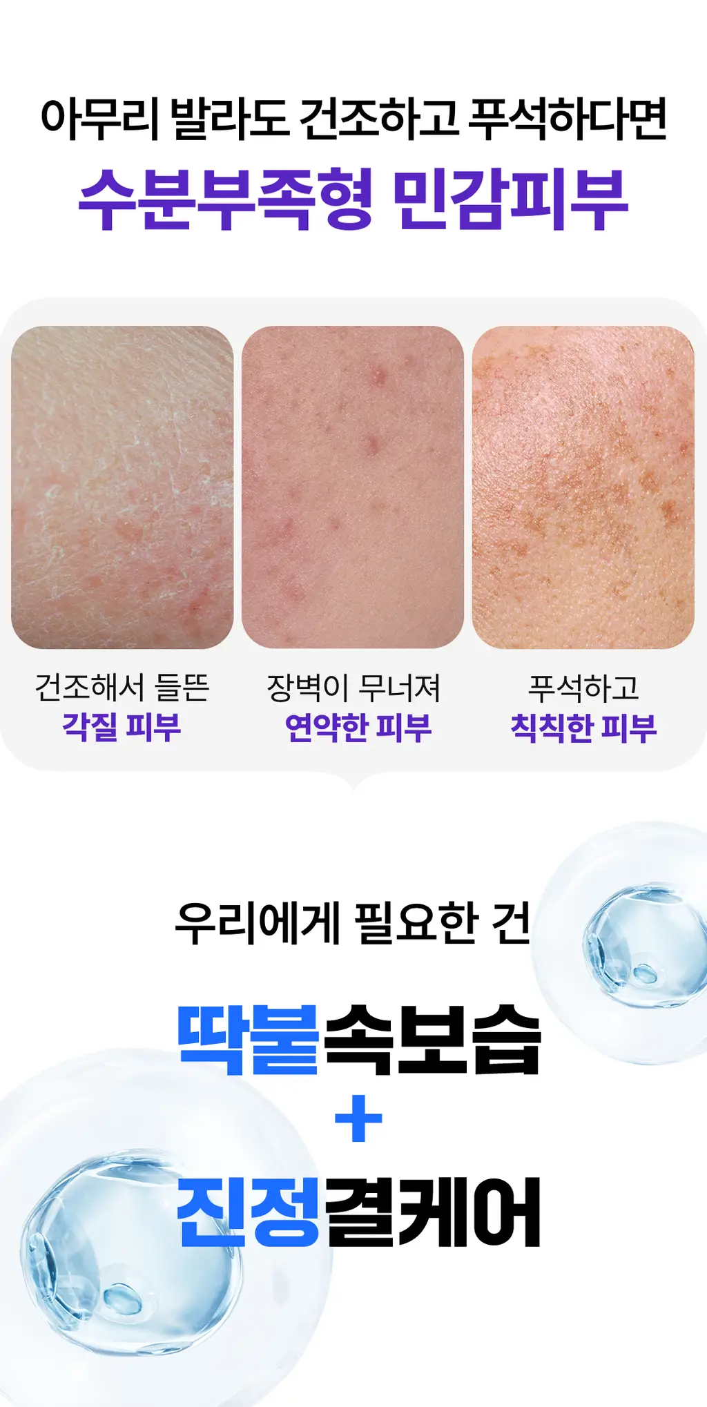 [올영단독] 스킨앤랩 베리어덤 링거 앰플70ml(+70ml) 더블기획 상세페이지 8